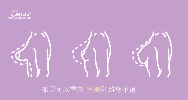 我們常說「如果可以重來」，就是因為「隆乳修復」的過程有著很複雜的因素與元素，一不做二不休，那打掉重練最快，完美胸型就離您不遠囉。