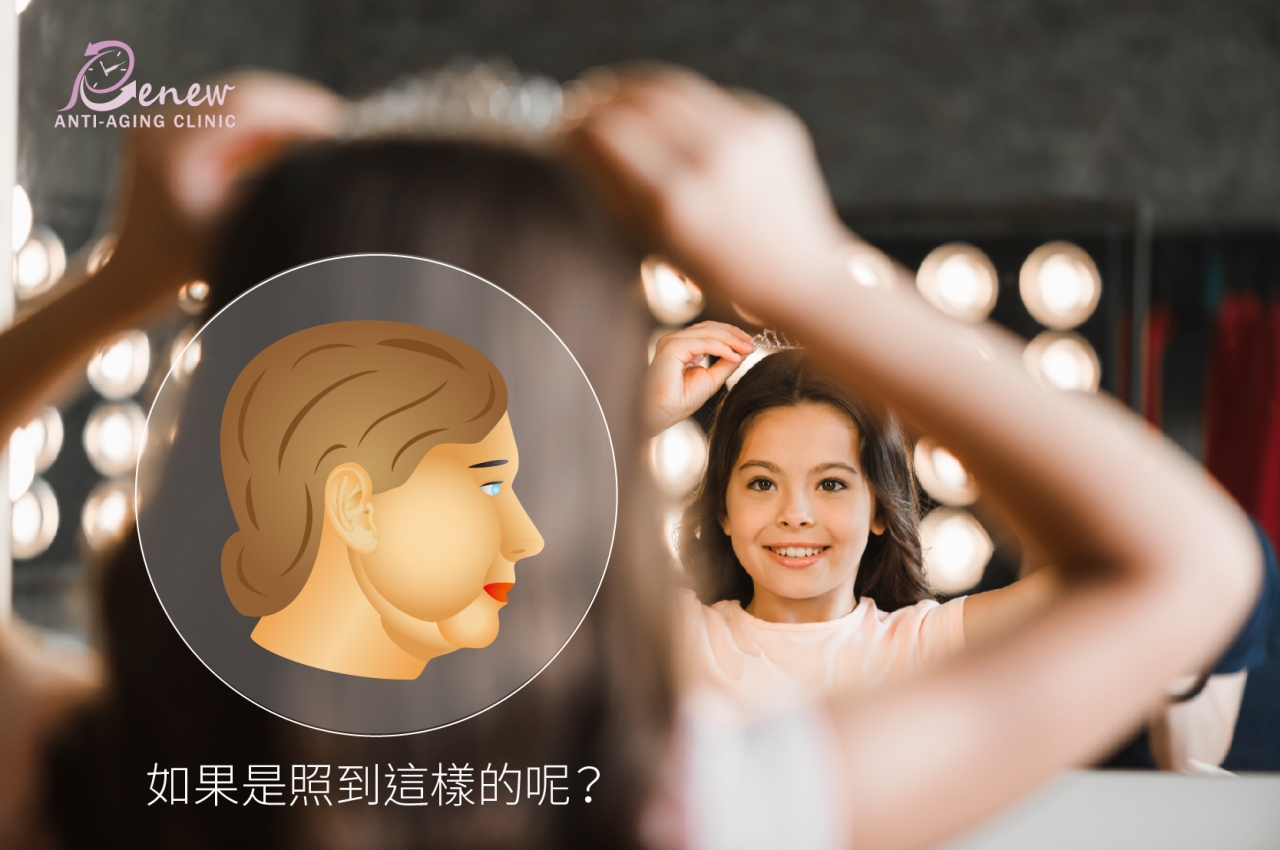 改良式鬱金香拉皮 ：聰明作中下臉的「面子」功夫