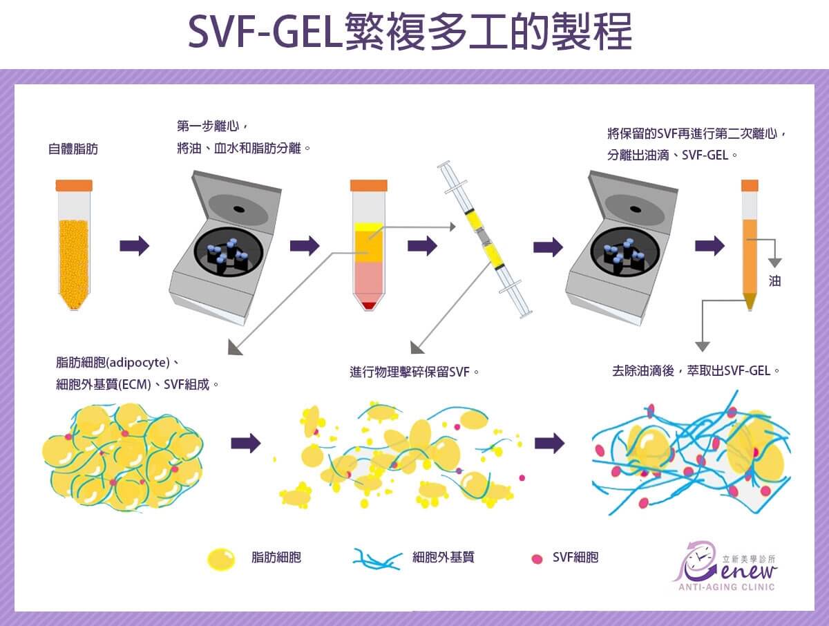 SVF-GEL繁複多工的製程