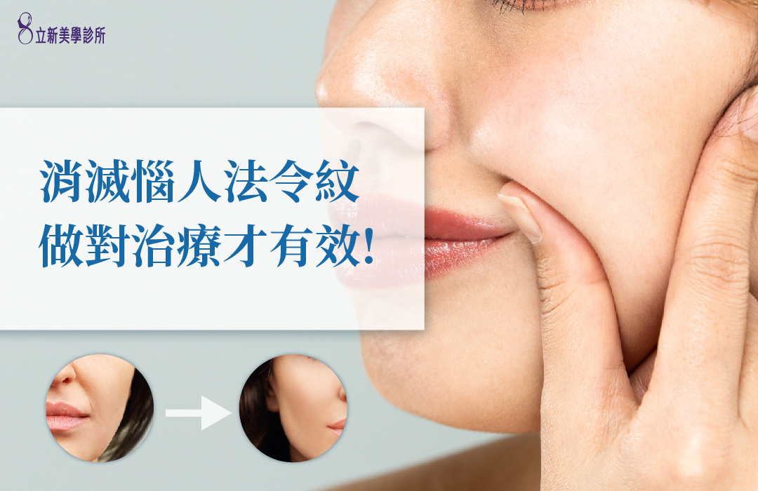 消滅惱人法令紋 做對治療才有效!