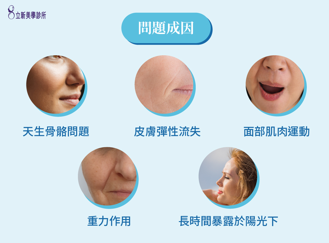 問題成因:天生骨骼問題 皮膚彈性流失 面部肌肉運動 重力作用 長時間暴露於陽光下