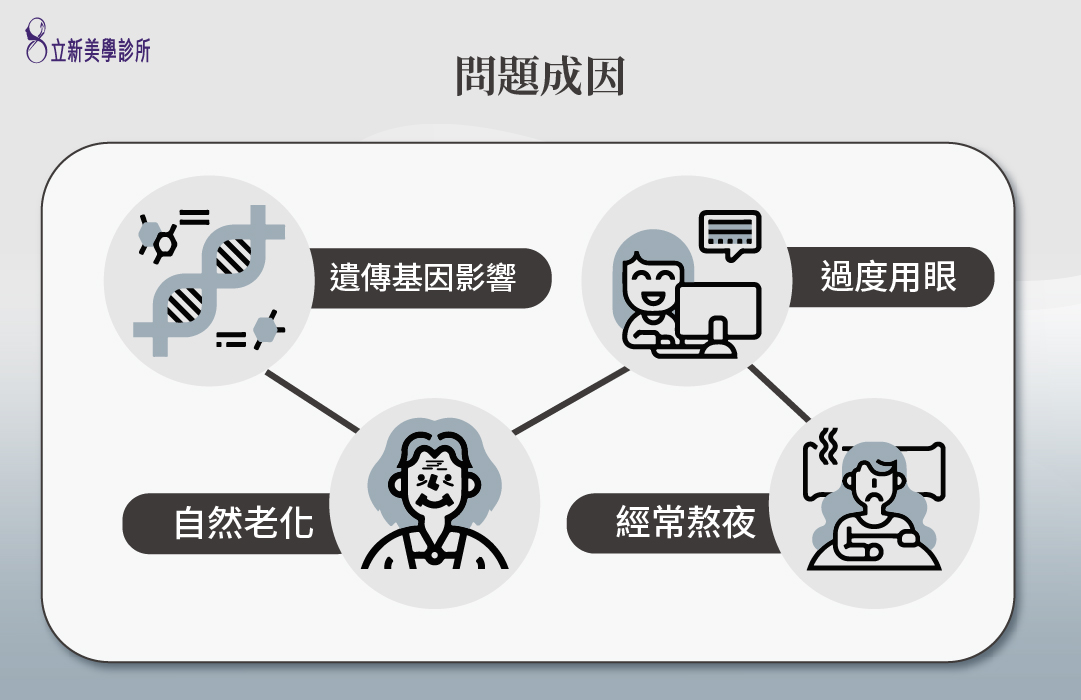 問題成因 遺傳基因影響 過度用眼 自然老化 經常熬夜
