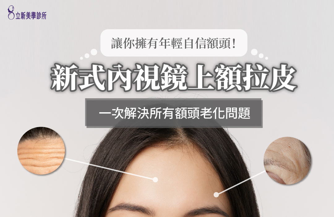 讓你擁有年輕自信額頭!新式內視鏡上額拉皮 一次解決所有額頭老化問題