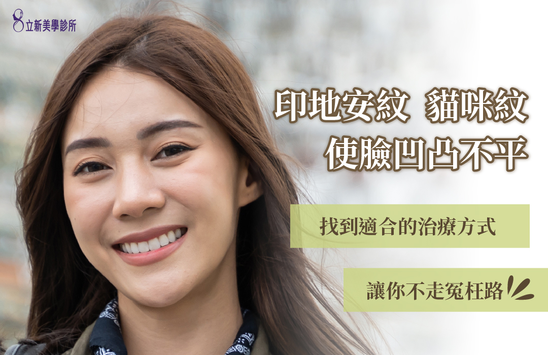 印地安紋 貓咪紋 使臉凹凸不平 找到適合的治療方式 讓你不走冤枉路