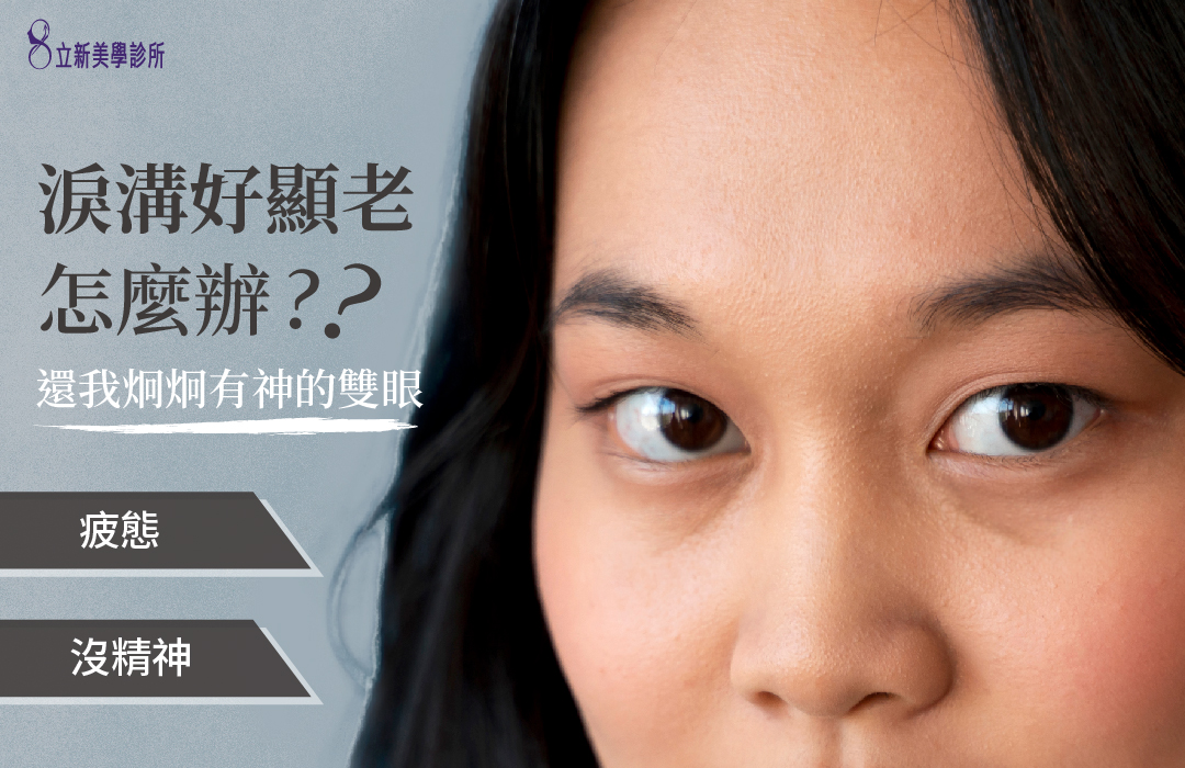 淚溝好顯老怎麼辦?還我炯炯有神的雙眼 疲態 沒精神