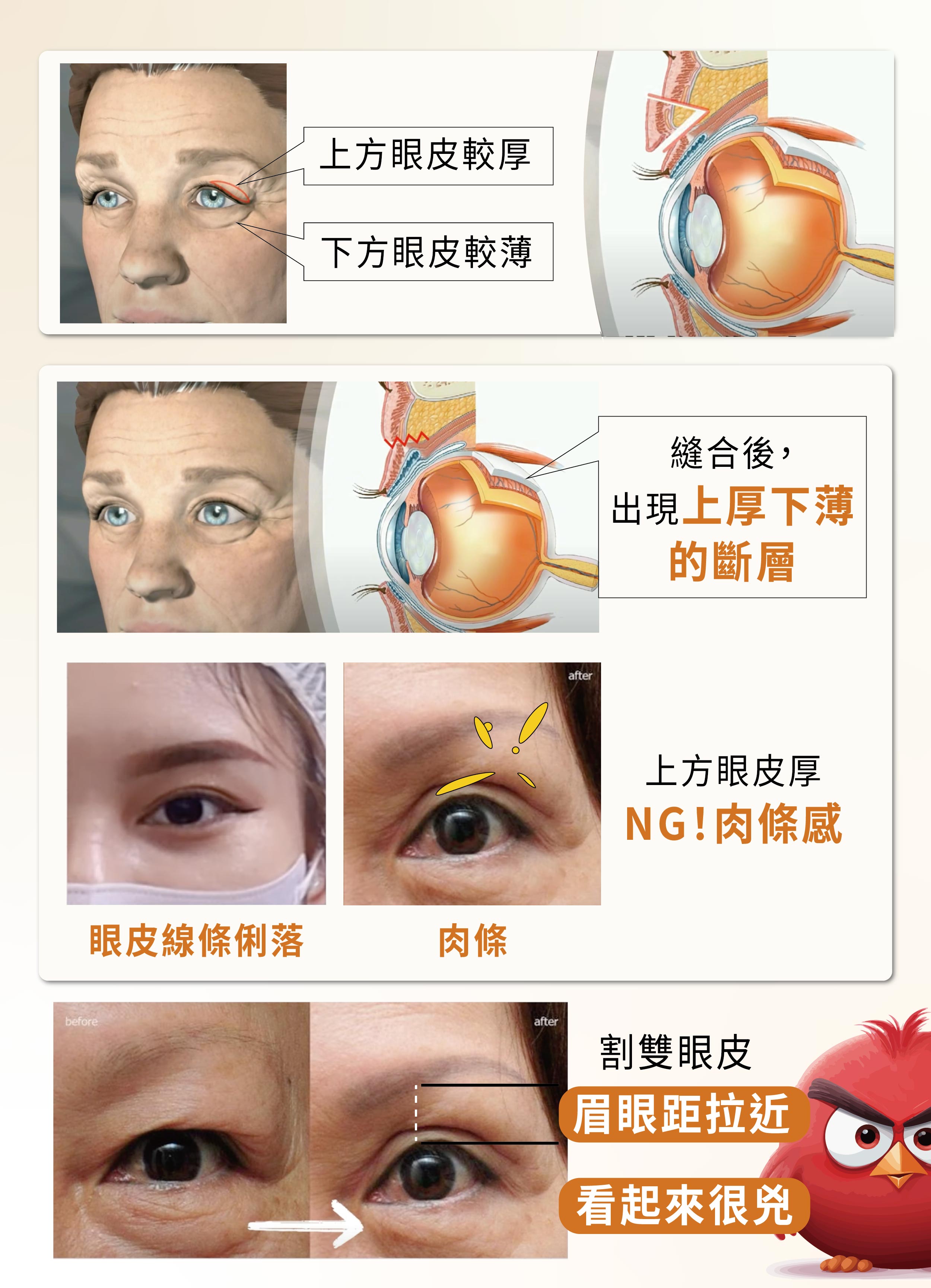 (對比圖)