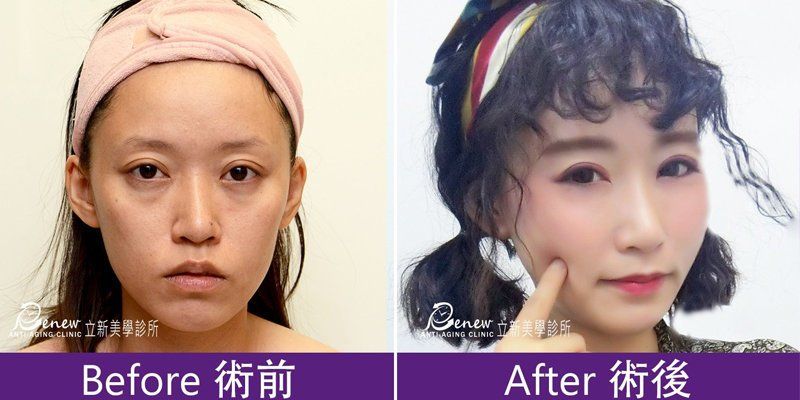 (对比图)