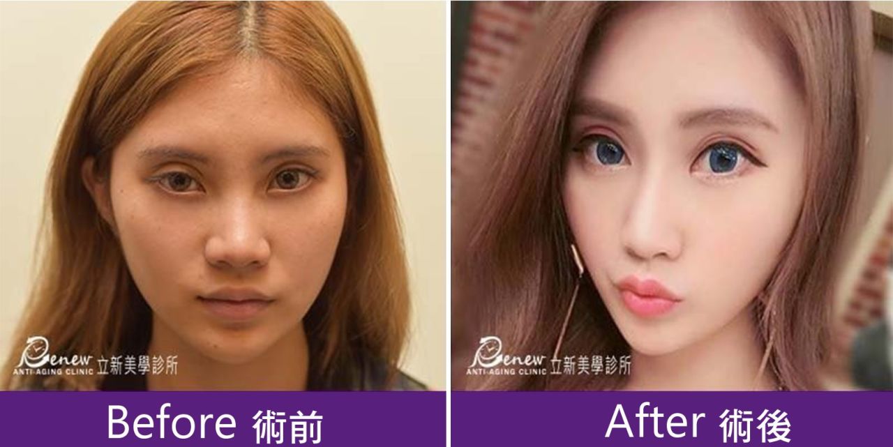 (对比图)