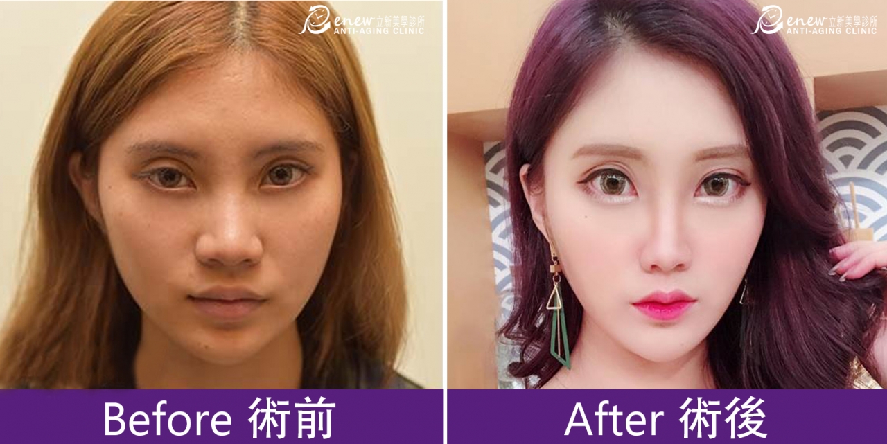 (对比图)
