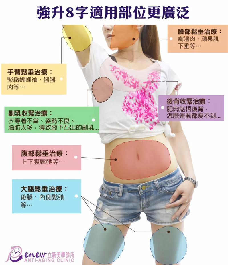 强升8字适用部位更广泛
