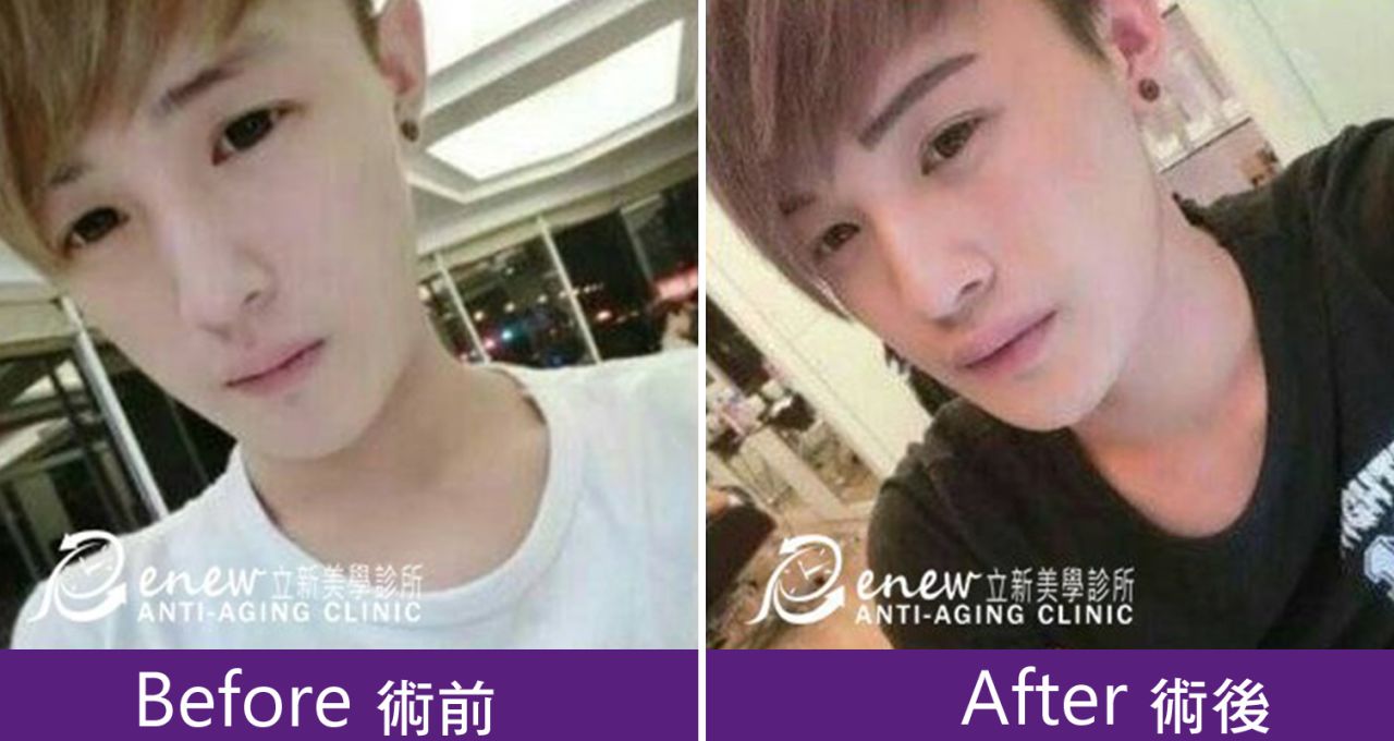 (对比图)