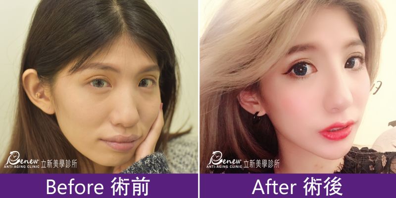 (对比图)