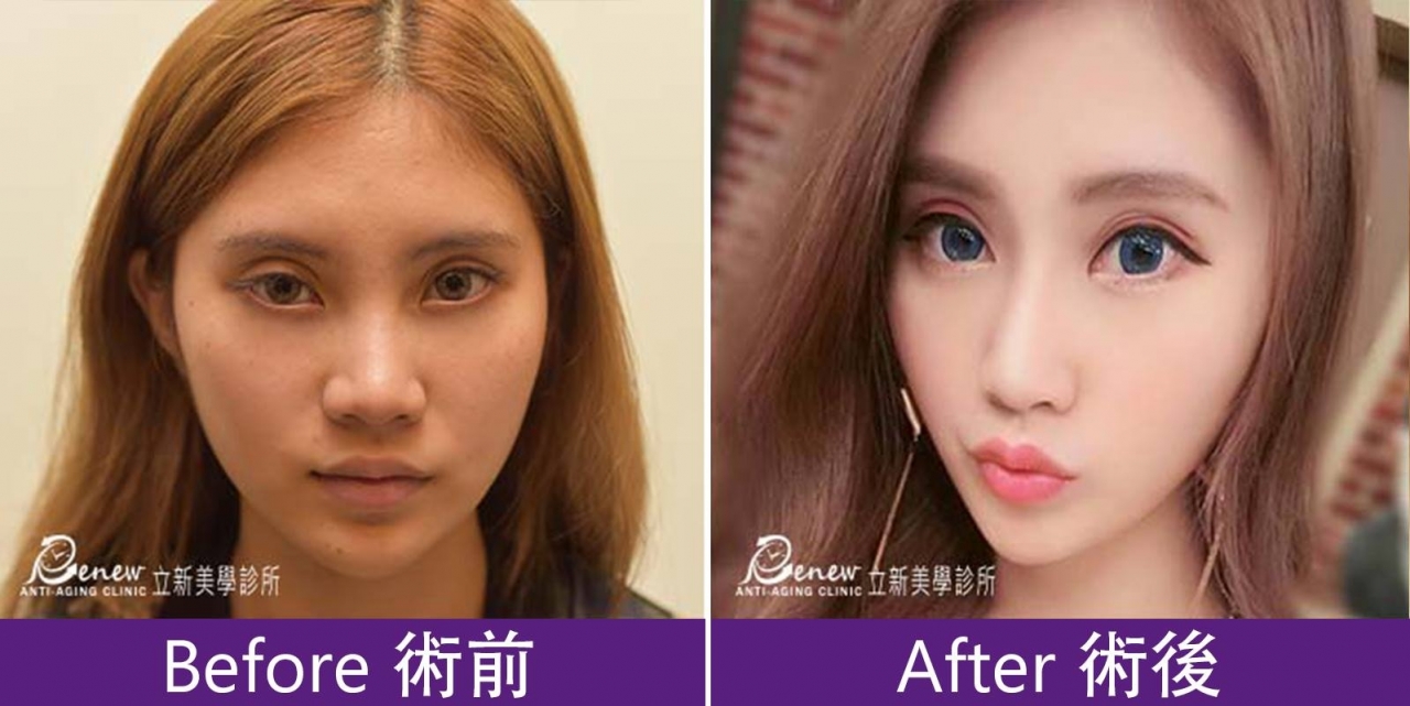 (对比图)