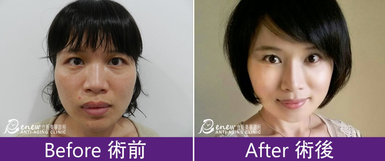 (对比图)