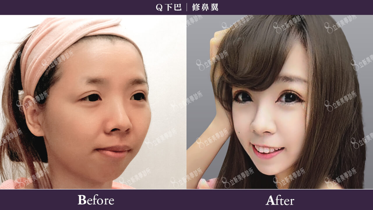 (对比图)
