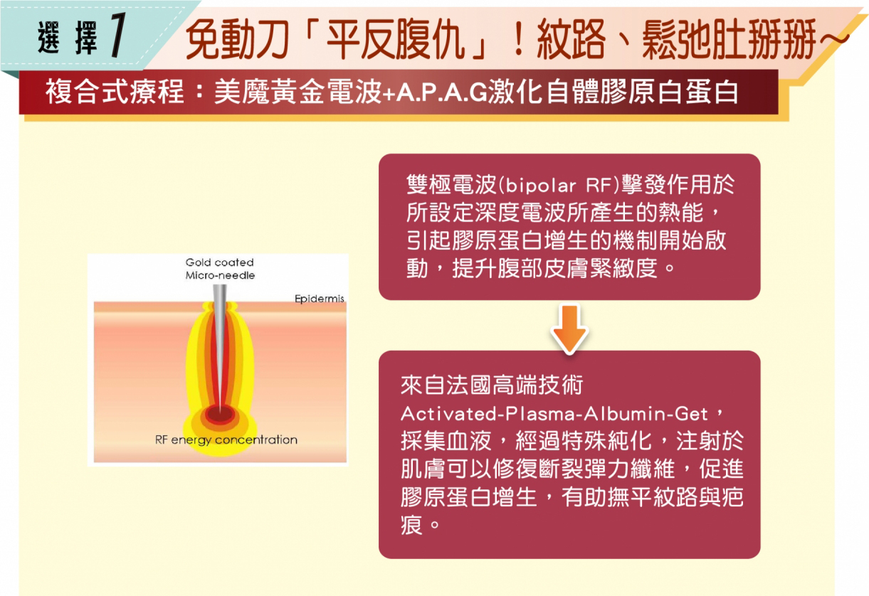【全新8字线凋】强升8字线化腐朽为完美　免动刀效果堪比拉皮！蝴蝶袖、肚皮也帮您收紧紧，腹部拉提中心三大疗程技术，拯救产后准妈咪崩坏肚皮，选择一，免动刀平反腹肌，纹路、松弛肚掰掰~複合式疗程：美魔黄金电波+APAG激化自体胶原白蛋白，双极电波(bipolar RF)击发作用于所设定深度电波所产生的热能，引起胶原蛋白增生的机制开始启动，提升腹部皮肤紧緻度，来自法国高端技术，Activated-Plasma-Albumin-Get，採集血液，经过特殊纯化，注射于肌肤可以修復断裂弹力纤维，促进胶原蛋白增生，有助于抚平纹路与疤痕，