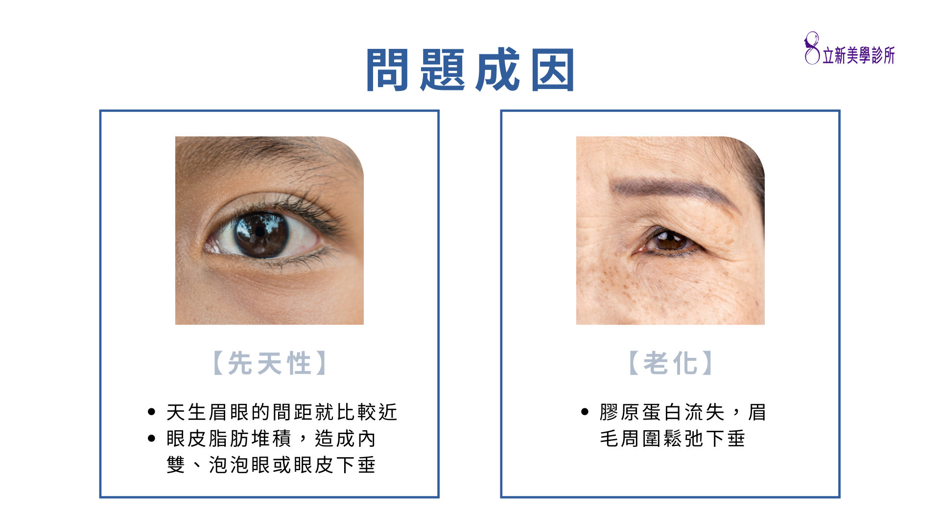【先天性】 ·天生眉眼的间距就比较近 ·眼皮脂肪堆积,造成内 双、泡泡眼或眼皮下垂，【老化】 ·胶原蛋白流失,眉 毛周围松弛下垂