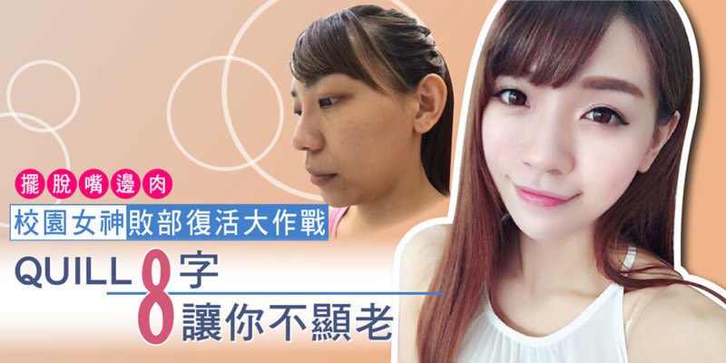 摆脱嘴边肉 校园女神 败部复活大作战 线雕拉提-8字 让你不显老