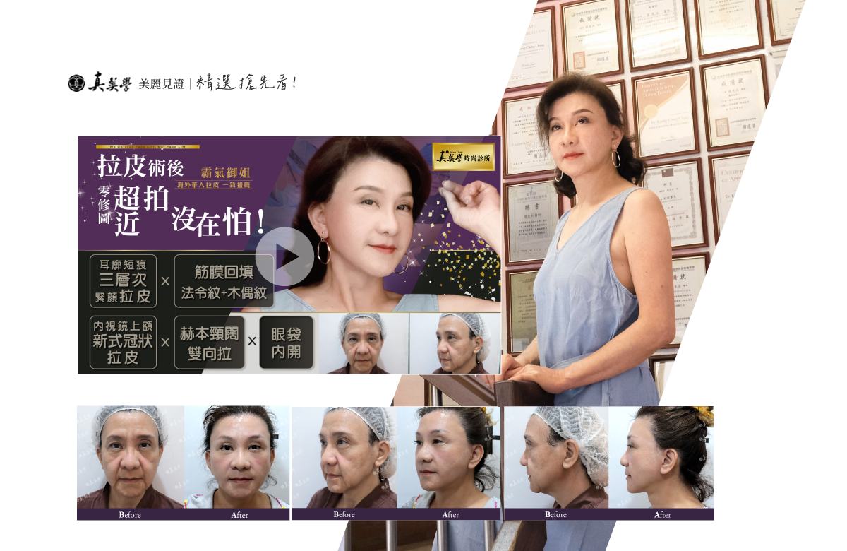 真美学美學美麗見證精選搶先看