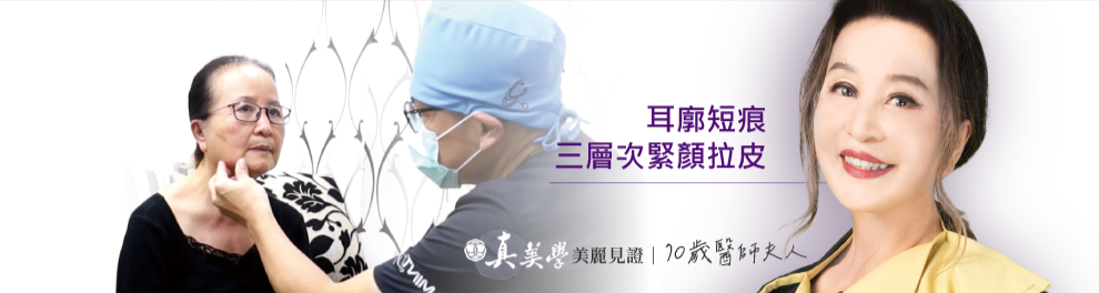 美麗見證,耳廓短痕三層次緊顏拉皮